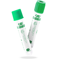 Ống Nghiệm Lấy Máu CITRATE URI