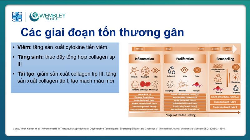 Bài báo cáo: Ứng dụng PRP trong điều trị bệnh lý viêm gân 