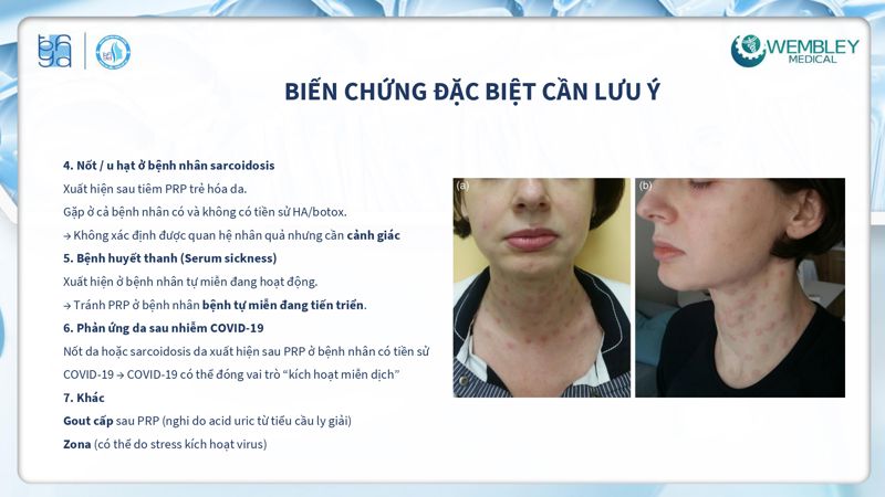 Bài báo cáo: Tối ưu hóa ứng dụng của PRP cho da ngoài vùng đầu - mặt