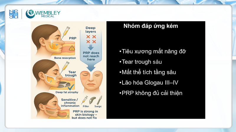 Presentation: Optimizing the Application of PRP in Facial Skin Treatments