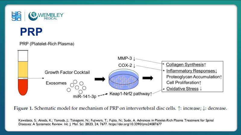 Bài báo cáo: Hiệu quả của huyết tương giàu tiểu cầu trong điều trị đau mạn tính