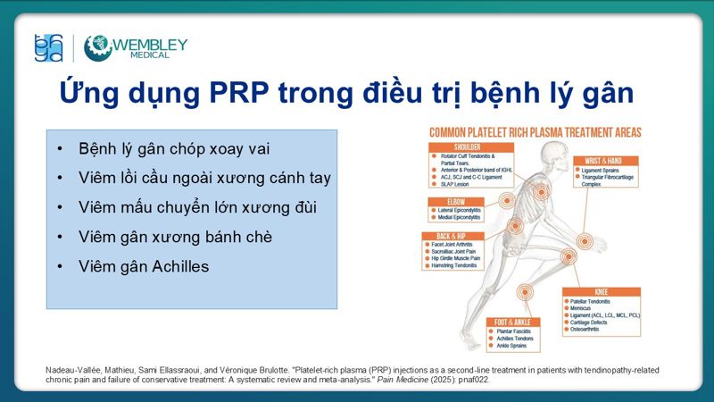 Bài báo cáo: Ứng dụng PRP trong điều trị bệnh lý viêm gân 