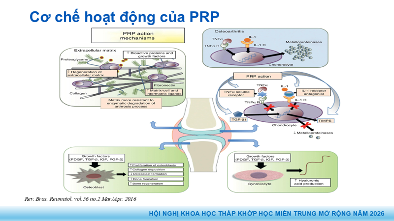 Bài báo cáo: Vai trò của Huyết tương giàu tiểu cầu trong điều trị thoái hóa khớp