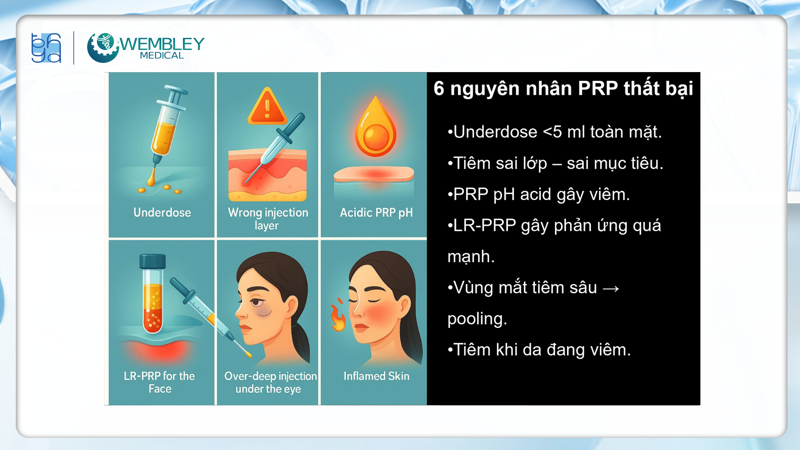 Presentation: Optimizing the Application of PRP in Facial Skin Treatments