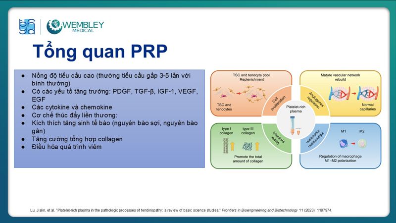 Bài báo cáo: Ứng dụng PRP trong điều trị bệnh lý viêm gân 