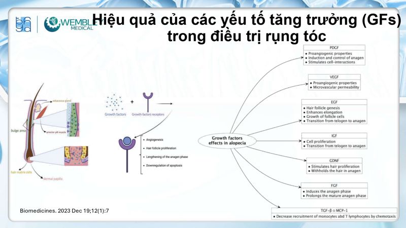Bài báo cáo: Nguồn sống tự thân cho các vấn đề của da đầu: Tiềm năng sinh học của huyết tương giàu tiểu cầu
