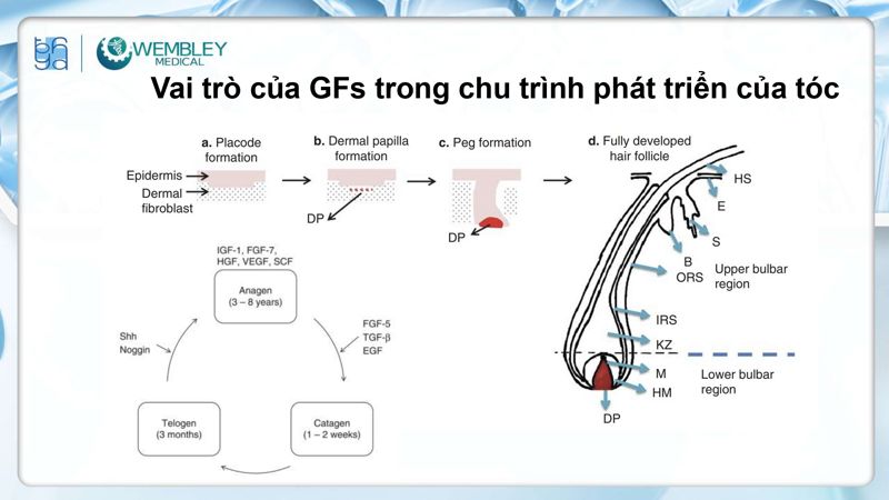 Bài báo cáo: Nguồn sống tự thân cho các vấn đề của da đầu: Tiềm năng sinh học của huyết tương giàu tiểu cầu