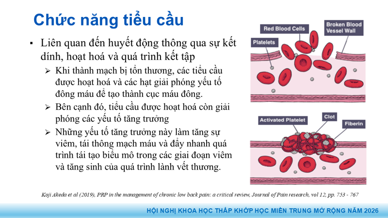 Bài báo cáo: Vai trò của Huyết tương giàu tiểu cầu trong điều trị thoái hóa khớp