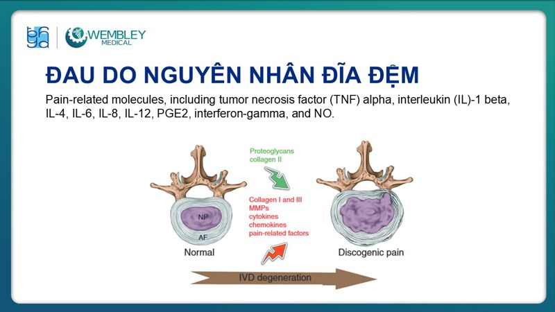 Bài báo cáo: Hiệu quả của huyết tương giàu tiểu cầu trong điều trị đau mạn tính