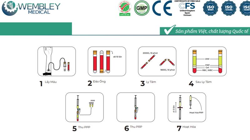 Bài báo cáo: Vai trò của PRP trong điều trị thoái hóa khớp