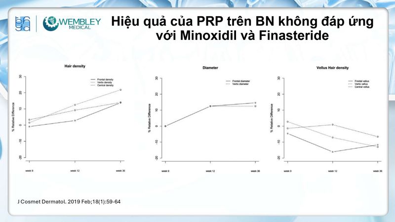 Bài báo cáo: Nguồn sống tự thân cho các vấn đề của da đầu: Tiềm năng sinh học của huyết tương giàu tiểu cầu