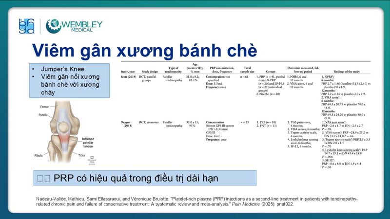 Bài báo cáo: Ứng dụng PRP trong điều trị bệnh lý viêm gân 