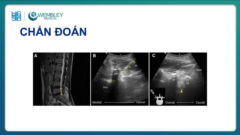 Bài báo cáo: Hiệu quả của huyết tương giàu tiểu cầu trong điều trị đau mạn tính