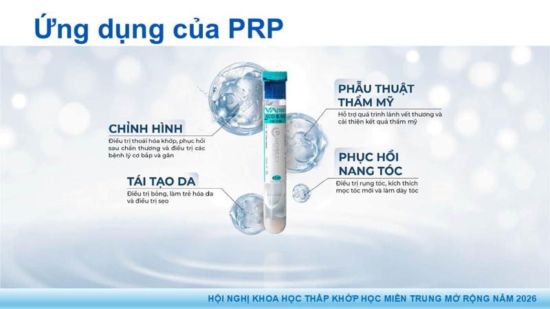 Bài báo cáo: Vai trò của Huyết tương giàu tiểu cầu trong điều trị thoái hóa khớp