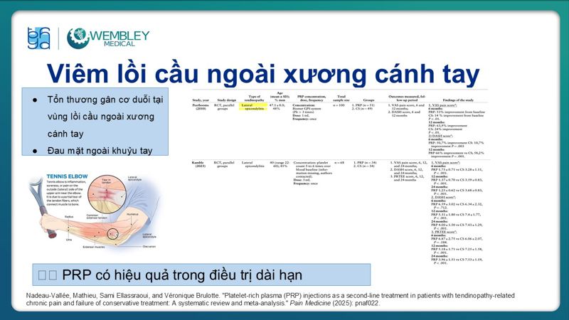 Bài báo cáo: Ứng dụng PRP trong điều trị bệnh lý viêm gân 