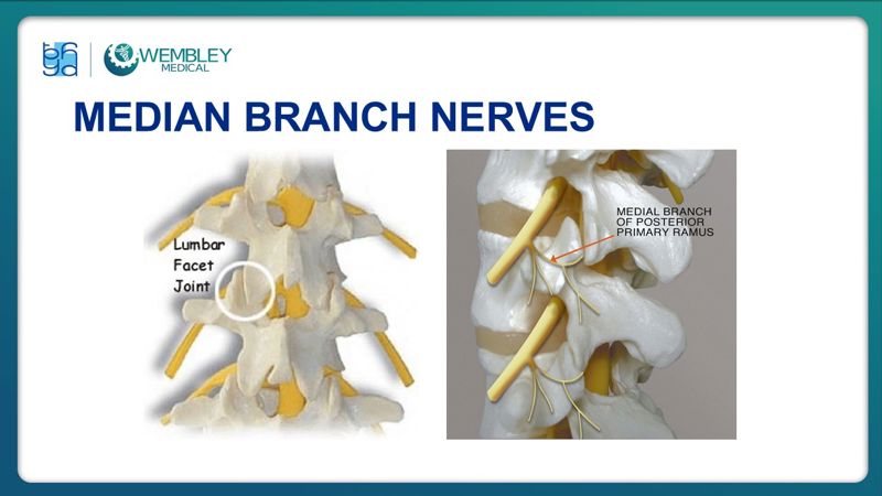 Bài báo cáo: Hiệu quả của huyết tương giàu tiểu cầu trong điều trị đau mạn tính