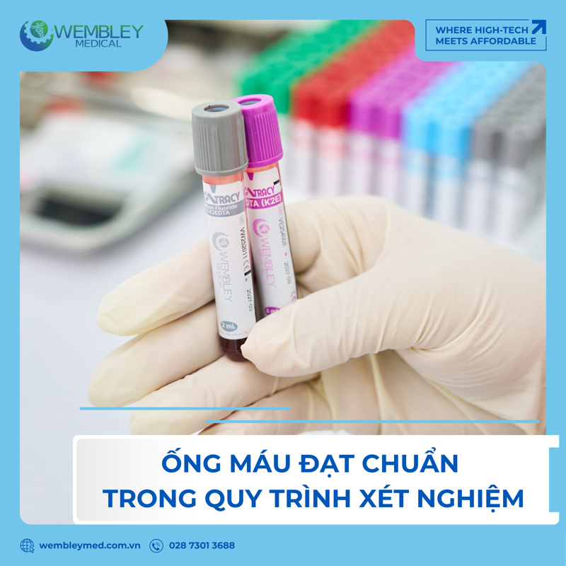 Ống lấy máu đạt chuẩn: Mắt xích nhỏ nhưng quan trọng của những quyết định chẩn đoán y khoa