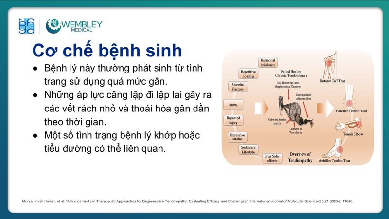Bài báo cáo: Ứng dụng PRP trong điều trị bệnh lý viêm gân 